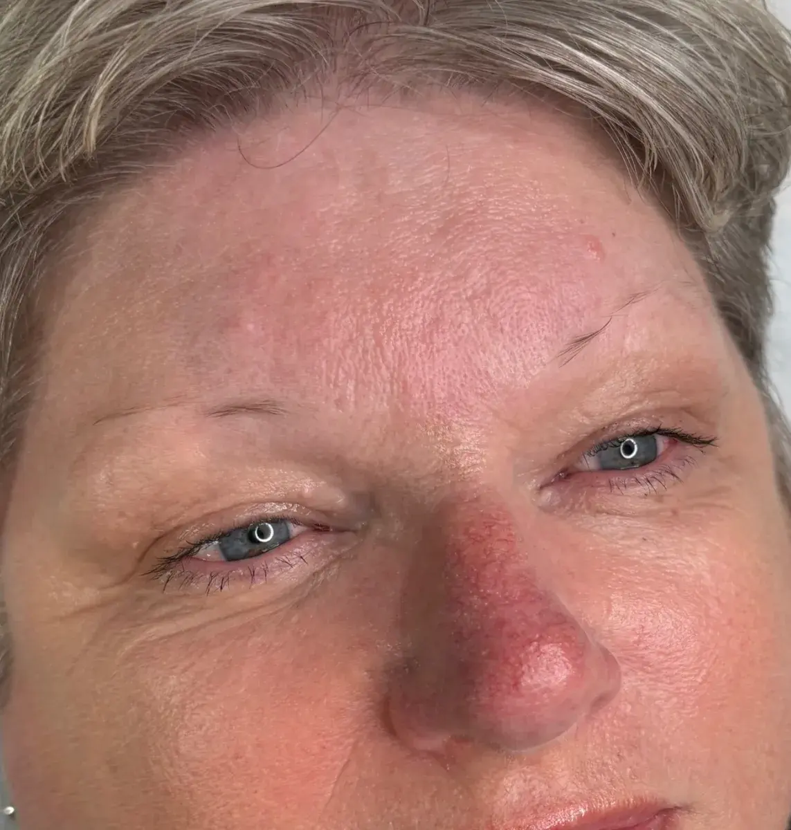 Microblading · Before — client result